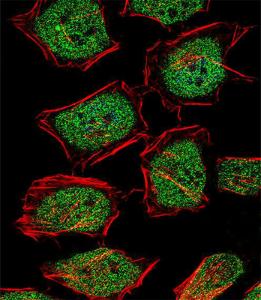 Anti-NR3C1 Rabbit Polyclonal Antibody (FITC (Fluorescein Isothiocyanate))