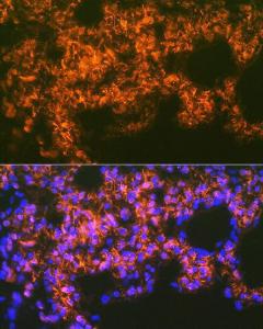 Anti-Mesothelin Rabbit Monoclonal Antibody [clone: ARC1464]