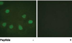 Anti-RB1 Rabbit Polyclonal Antibody