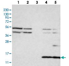 Anti-CYB561D1 Rabbit Polyclonal Antibody