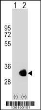 Anti-GNMT Rabbit Polyclonal Antibody (PE (Phycoerythrin))