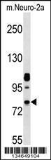 Anti-NEK8 Rabbit Polyclonal Antibody (AP (Alkaline Phosphatase))