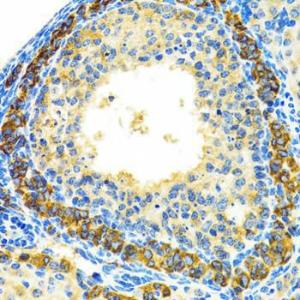 Immunohistochemistry analysis of paraffin-embedded rat ovary using Anti-MRPL28 Antibody (A9764) at a dilution of 1:100 (40x lens). Perform microwave antigen retrieval with 10 mM PBS buffer pH 7.2 before commencing with IHC staining protocol