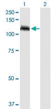 Anti-TUBGCP5 Rabbit Polyclonal Antibody