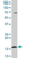 Anti-PPIL1 Mouse Polyclonal Antibody