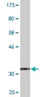 Anti-RBM3 Mouse Monoclonal Antibody [clone: 4D6]