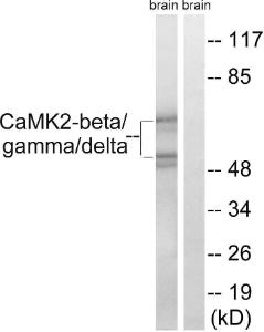 Western blot analysis of lysates from rat brain cells using Anti-CaMK2 beta + gamma + delta Antibody. The right hand lane represents a negative control, where the antibody is blocked by the immunising peptide