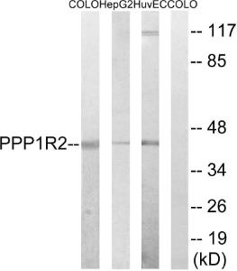 Anti-Protein phosphatase 1 inhibitor subunit 2 Rabbit Polyclonal Antibody