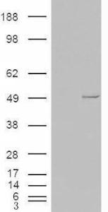 HEK293 overexpressing CSNK1E (RC202436) and probed with Anti-CSNK1E Antibody (A83740) (mock transfection in first lane), tested by Origene