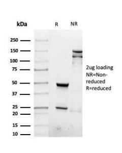 SDS-PAGE analysis of Anti-Interferon gamma Antibody [rIFNG/4467] under non-reduced and reduced conditions; showing intact IgG and intact heavy and light chains, respectively. SDS-PAGE analysis confirms the integrity and purity of the antibody