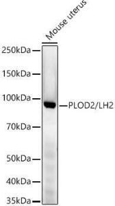 Western blot analysis of extracts of Mouse uterus, using Anti-PLOD2 / LH2 Antibody [ARC54359] (A306311) at 1:30000 dilution