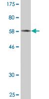 Anti-PDXK Mouse Monoclonal Antibody [clone: 4G6]