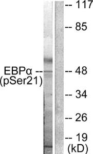 Anti-CEBP Alpha Rabbit Polyclonal Antibody