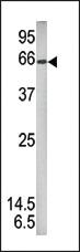 Anti-STAT1 Rabbit Polyclonal Antibody