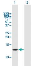 Anti-GNRH1 Mouse Polyclonal Antibody