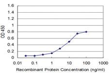 Anti-RAX Mouse Monoclonal Antibody [clone: 3G8]