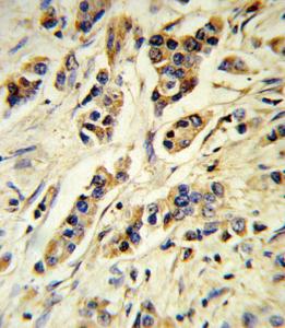 Anti-IL10 Rabbit Polyclonal Antibody