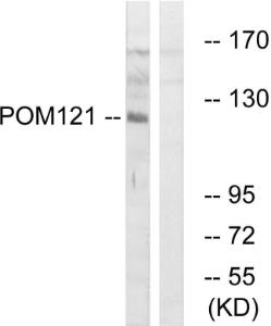 Western blot analysis of lysates from K562 cells using Anti-POM121 Antibody. The right hand lane represents a negative control, where the antibody is blocked by the immunising peptide.