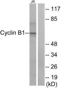 Anti-Cyclin B1 Rabbit Polyclonal Antibody