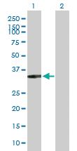 Anti-XRCC2 Rabbit Polyclonal Antibody