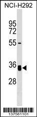 Anti-GNPTG Rabbit Polyclonal Antibody (FITC (Fluorescein Isothiocyanate))