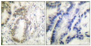 Anti-CEBP Alpha Rabbit Polyclonal Antibody