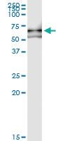 Anti-VRK2 Polyclonal Antibody Pair