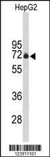 Anti-FBXO3 Rabbit Polyclonal Antibody (Biotin)