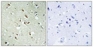 Immunohistochemical analysis of paraffin-embedded human brain using Anti-POM121 Antibody 1:100 (4°C overnight). The right hand panel represents a negative control, where the antibody was pre-incubated with the immunising peptide.