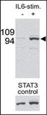 Anti-STAT3 Rabbit Polyclonal Antibody