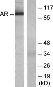 Western blot analysis of lysates from LOVO cells using Anti-Androgen Receptor Antibody The right hand lane represents a negative control, where the antibody is blocked by the immunising peptide