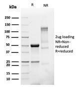 SDS-PAGE analysis of Anti-PMEPA1 Antibody [PMEPA1/6421R] under non-reduced and reduced conditions; showing intact IgG and intact heavy and light chains, respectively. SDS-PAGE analysis confirms the integrity and purity of the antibody