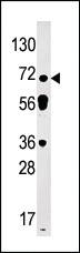 Anti-STAT3 Rabbit Polyclonal Antibody