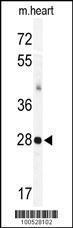 Anti-KCNIP3 Rabbit Polyclonal Antibody (APC (Allophycocyanin))