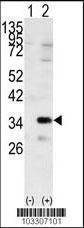 Anti-GNB2L1 Rabbit Polyclonal Antibody (FITC (Fluorescein))