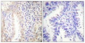 Anti-CEBP Alpha Rabbit Polyclonal Antibody