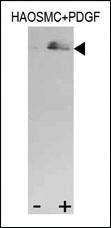 Anti-STAT3 Rabbit Polyclonal Antibody