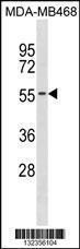 Anti-KCNK6 Rabbit Polyclonal Antibody (PE (Phycoerythrin))