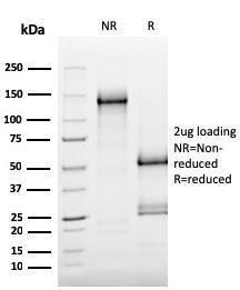 SDS-PAGE analysis of Anti-MerTK Antibody [MERTK/3015] under non-reduced and reduced conditions; showing intact IgG and intact heavy and light chains, respectively SDS-PAGE analysis confirms the integrity and purity of the antibody