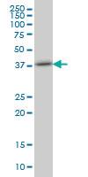 Anti-TRIB3 Mouse Monoclonal Antibody [clone: 2F7]