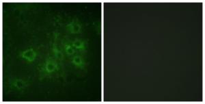 Immunofluorescence analysis of COS7 cells using Anti-Synapsin1 (phospho Ser605) Antibody. The right hand panel represents a negative control, where the antibody was pre-incubated with the immunising peptide.