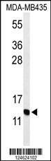 Anti-GNRH2 Rabbit Polyclonal Antibody (FITC (Fluorescein Isothiocyanate))