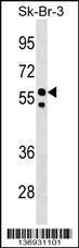 Anti-FBXO31 Rabbit Polyclonal Antibody (FITC (Fluorescein Isothiocyanate))