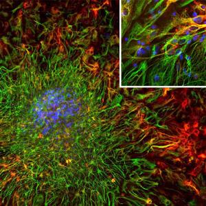 Immunofluorescent analysis of cortical neuron-glial cell culture from E20 rat stained with Anti-ALDH1L1 Antibody [2E7] (A85314)