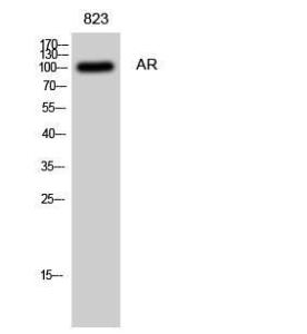 Western blot analysis of 823 cells using Anti-Androgen Receptor Antibody