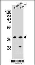 Anti-CELF6 Rabbit Polyclonal Antibody