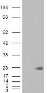 HEK293 overexpressing SAR1B (RC210593) and probed with Anti-SAR1B Antibody (A83745) (mock transfection in first lane), tested by Origene