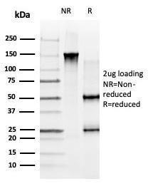 SDS-PAGE analysis of Anti-GLIS3 Antibody [PCRP-GLIS3-1B11] under non-reduced and reduced conditions; showing intact IgG and intact heavy and light chains, respectively. SDS-PAGE analysis confirms the integrity and purity of the Antibody