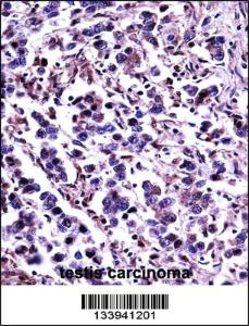 Anti-CAPN11 Rabbit Polyclonal Antibody (FITC (Fluorescein Isothiocyanate))