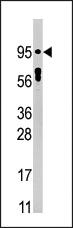 Anti-STAT5A Rabbit Polyclonal Antibody